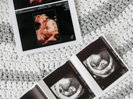 échographie grossesse