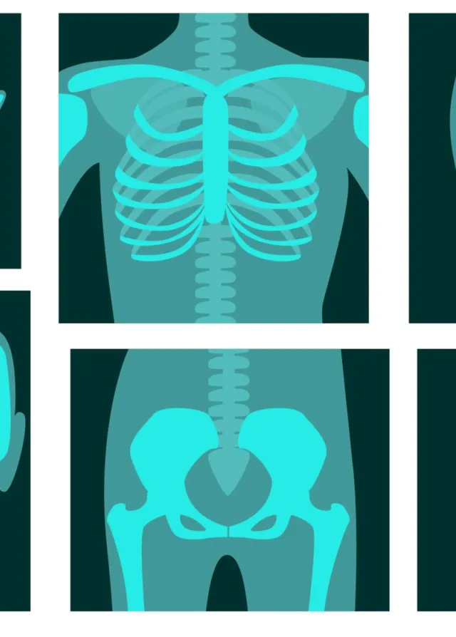 Image du squelette humain a travers des radiologies, représentant la spécialité chirurgicale d'orthopédie traumatologique.