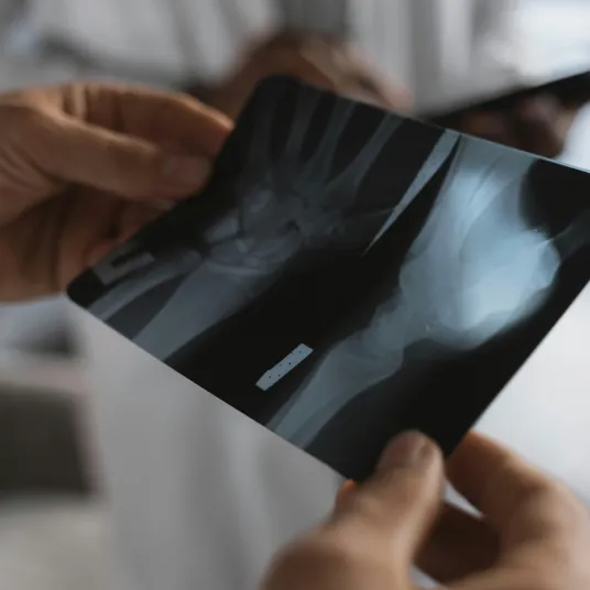 ZOom sur les mains d'une médecin regardant la radiothérapie d'un patient