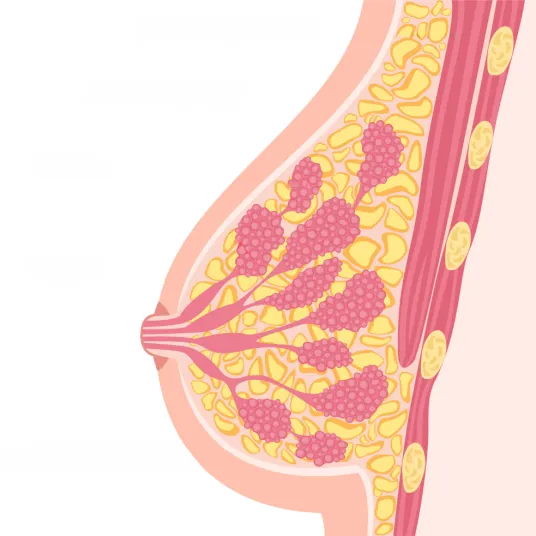 Comprendre le cancer du sein