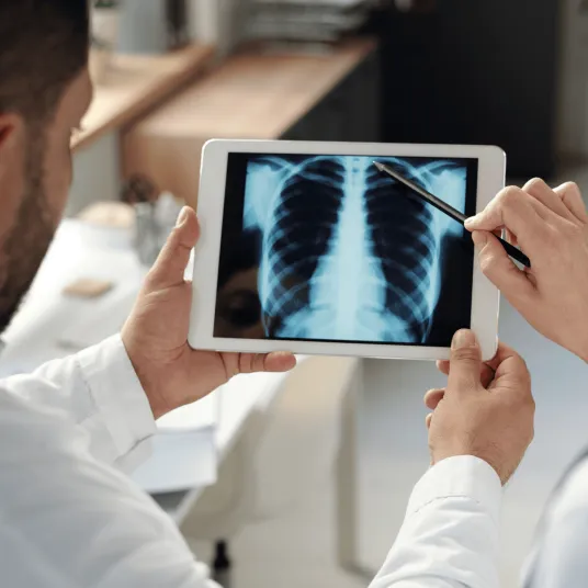 Pneumologue analyse une radio de la cage thoracique