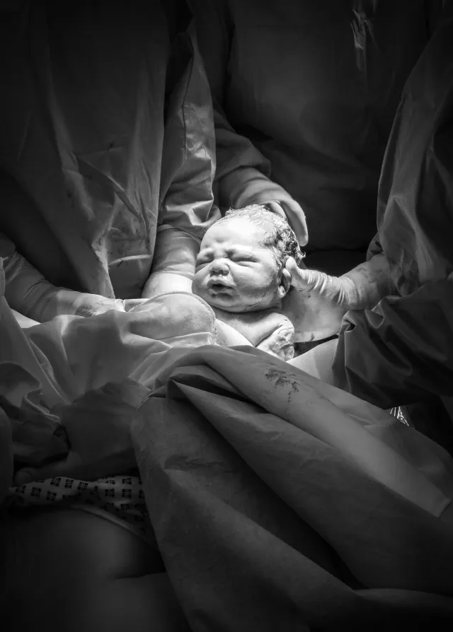 Naissance d'un bébé par césarienne participative