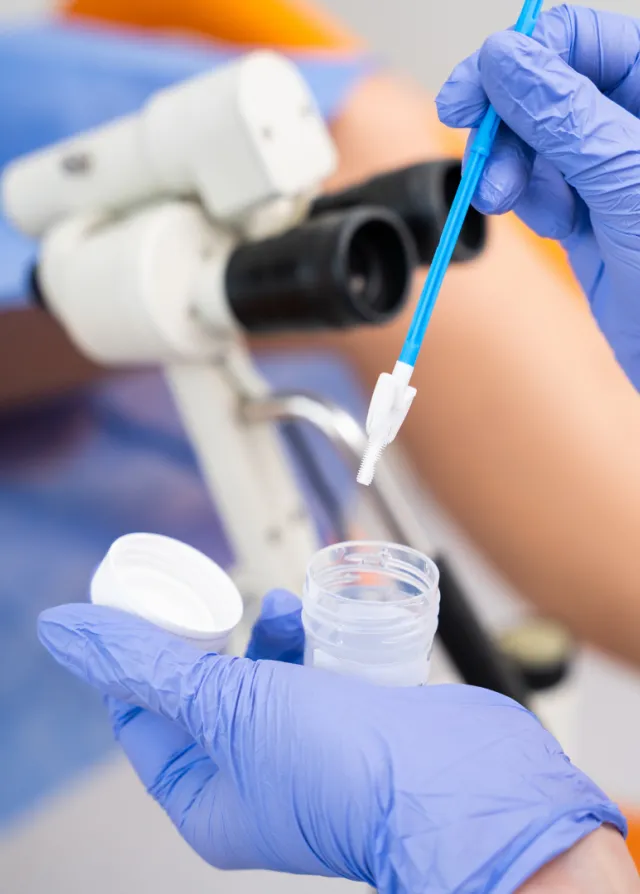 Gynécologue réalisant un frottis