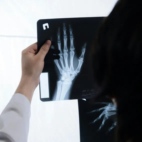 Médecin regardant la radiologie d'une main - Groupe Vivalto Santé