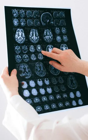 Médecine regardant la radiothérapie d'un patient