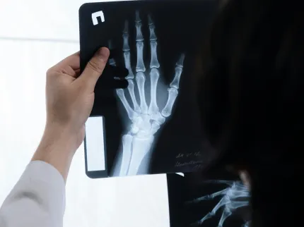 Médecin regardant la radiologie d'une main. Groupe Vivalto Santé