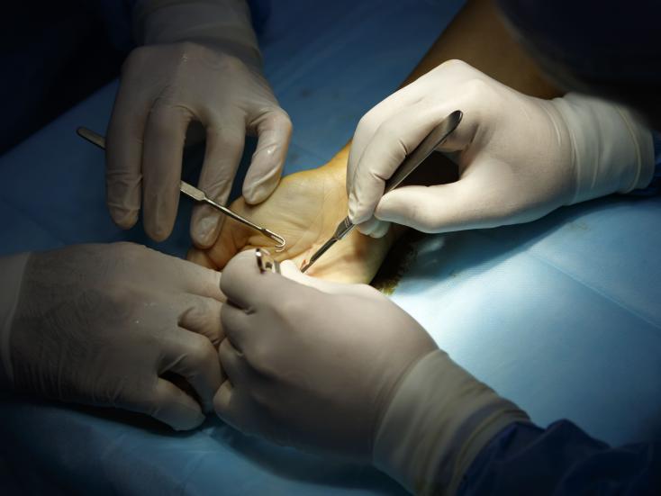 Chirurgie de la main