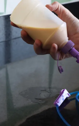 Nutrition entérale avec Vivalto Dom