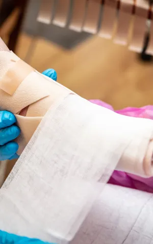 Plaies et cicatrisation avec Vivalto Dom