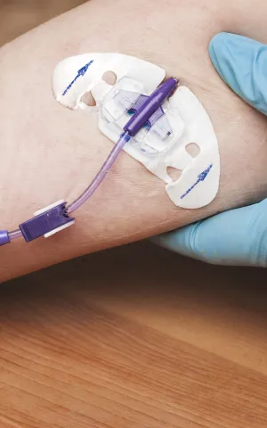 Pose d'un picc line Vivalto Dom